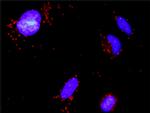 GSTP1 Antibody in Proximity Ligation Assay (PLA) (PLA)