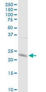 GSTP1 Antibody in Western Blot (WB)