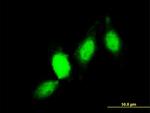 GSTP1 Antibody in Immunocytochemistry (ICC/IF)