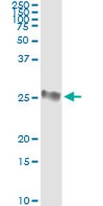 GSTP1 Antibody in Immunoprecipitation (IP)