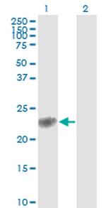 GSTP1 Antibody in Western Blot (WB)