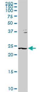 GSTZ1 Antibody in Western Blot (WB)
