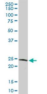 GSTZ1 Antibody in Western Blot (WB)