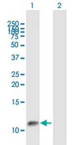 GTF2A2 Antibody in Western Blot (WB)