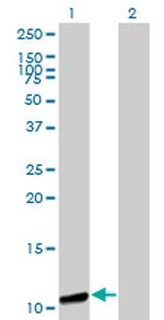 GTF2A2 Antibody in Western Blot (WB)