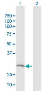 GTF2F2 Antibody in Western Blot (WB)