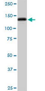 GTF2I Antibody in Western Blot (WB)