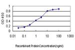 GTF2I Antibody in ELISA (ELISA)