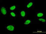 GTF2I Antibody in Immunocytochemistry (ICC/IF)