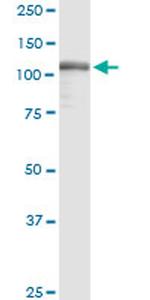 GTF2I Antibody in Western Blot (WB)