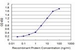 GTF2I Antibody in ELISA (ELISA)