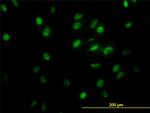 GTF2I Antibody in Immunocytochemistry (ICC/IF)