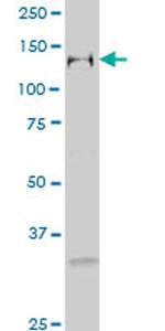 GTF2I Antibody in Western Blot (WB)