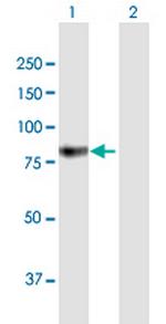 GUSB Antibody in Western Blot (WB)