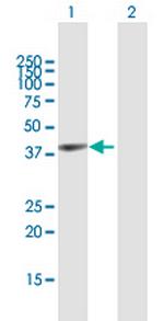 GYG1 Antibody in Western Blot (WB)