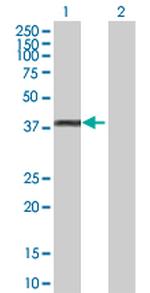 GYG1 Antibody in Western Blot (WB)