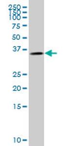 GYG1 Antibody in Western Blot (WB)