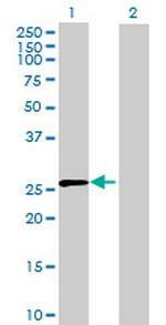 GZMK Antibody in Western Blot (WB)