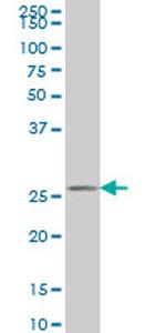 HAGH Antibody in Western Blot (WB)