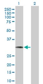 HCCS Antibody in Western Blot (WB)