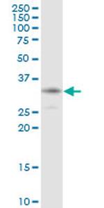 HCCS Antibody in Western Blot (WB)