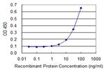 HCCS Antibody in ELISA (ELISA)