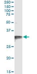 HCCS Antibody in Immunoprecipitation (IP)