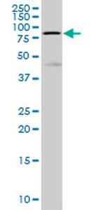 HCLS1 Antibody in Western Blot (WB)