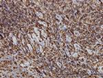 HCLS1 Antibody in Immunohistochemistry (Paraffin) (IHC (P))