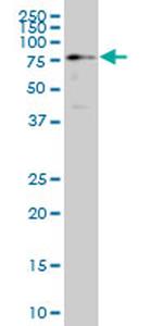 HCLS1 Antibody in Western Blot (WB)