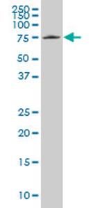 HCLS1 Antibody in Western Blot (WB)