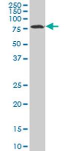 HCLS1 Antibody in Western Blot (WB)