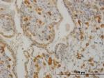 HCLS1 Antibody in Immunohistochemistry (Paraffin) (IHC (P))