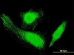 HD Antibody in Immunocytochemistry (ICC/IF)