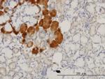 HD Antibody in Immunohistochemistry (Paraffin) (IHC (P))