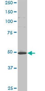 HD Antibody in Western Blot (WB)