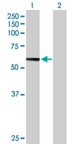 HEXB Antibody in Western Blot (WB)