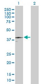 HFE Antibody in Western Blot (WB)