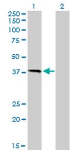 HFE Antibody in Western Blot (WB)