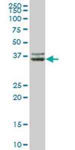 CFHR1 Antibody in Western Blot (WB)