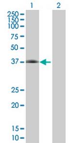 CFHR1 Antibody in Western Blot (WB)