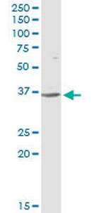 CFHR1 Antibody in Western Blot (WB)