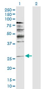 NRG1 Antibody in Western Blot (WB)