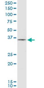 HHEX Antibody in Western Blot (WB)