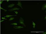 HHEX Antibody in Immunocytochemistry (ICC/IF)