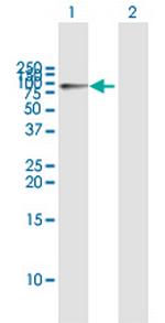 HK1 Antibody in Western Blot (WB)