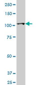 HK2 Antibody in Western Blot (WB)