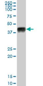 HLA-A Antibody in Western Blot (WB)