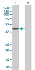 HLA-A Antibody in Western Blot (WB)