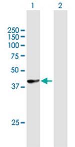 HLA-B Antibody in Western Blot (WB)